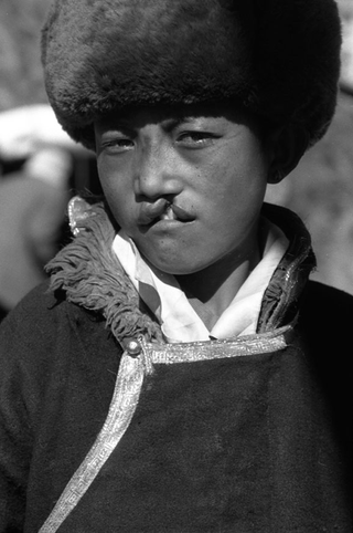 Interplast, 102-010-26
Ragazzo con labbro leporino, 2004
Shigatse (Cina, Tibet)